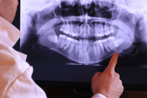 Best Emergency Tooth Extraction in Hoisington, KS